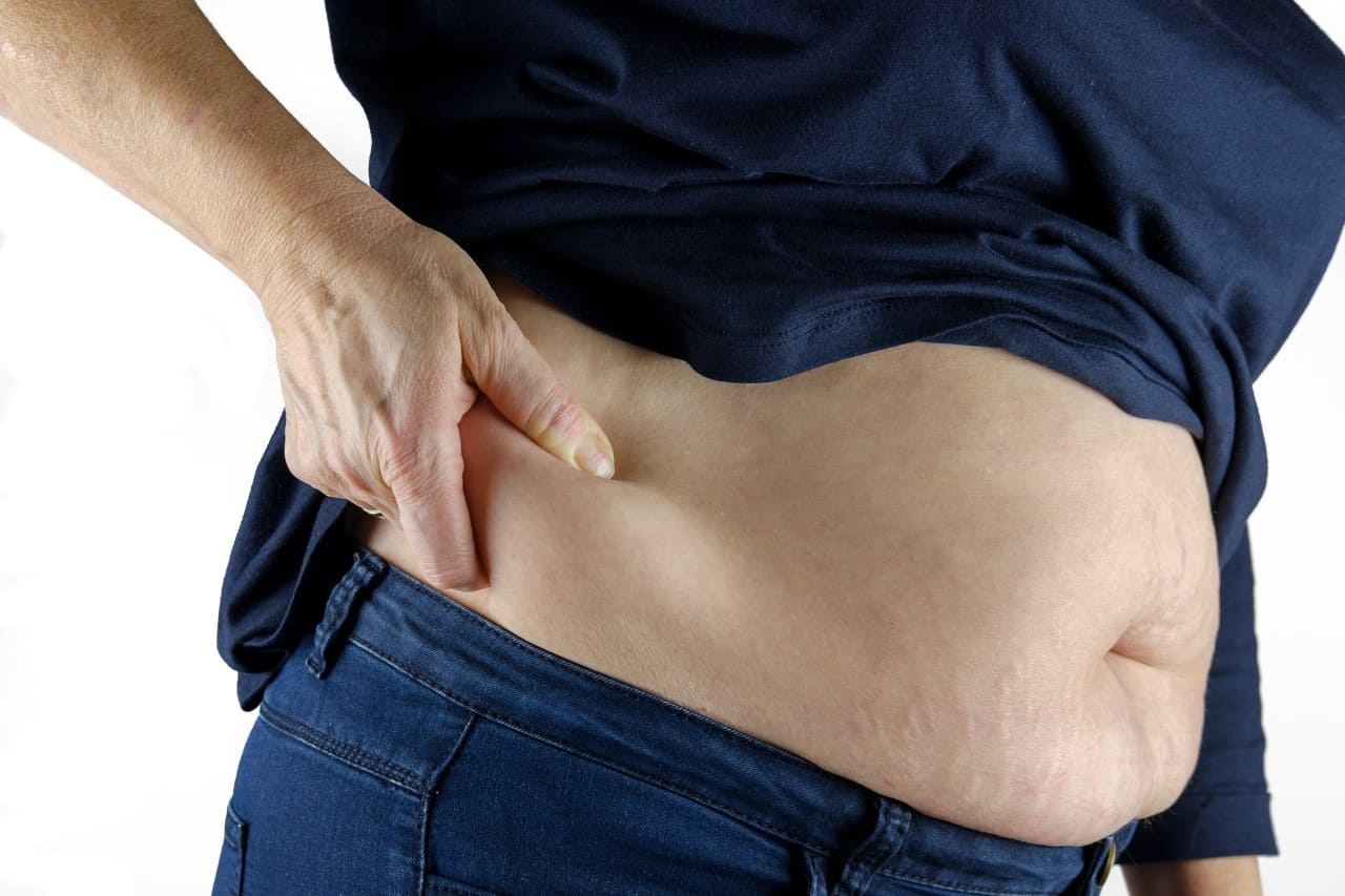 En este momento estás viendo Personas con sobrepeso son las más vulnerables al contagio por Covid 19