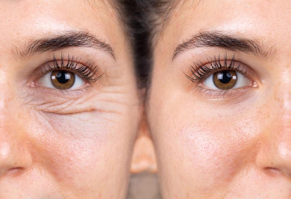 Clinica Andes Visión - Oculoplastia